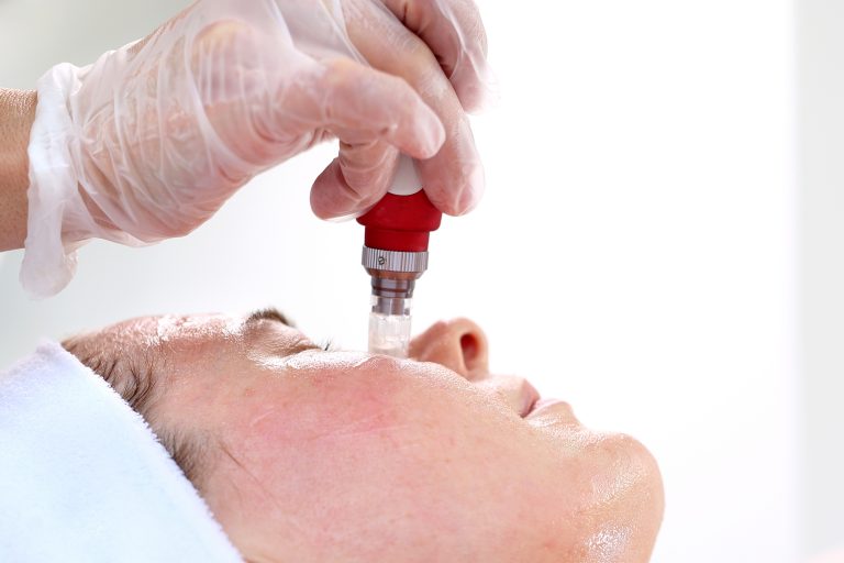 LaserTherapie  Hautarztpraxis Dr. Viehbeck  Hautarztpraxis Dr. Viehbeck